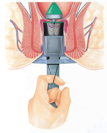 aimoroidopatheia6